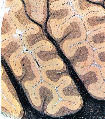 visão-microscópica-do-cerebelo-sistema-nervoso-humano